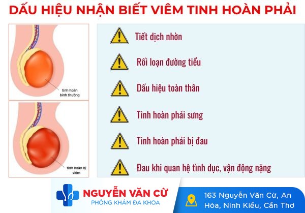 Cẩn Thận Với Chứng Viêm Tinh Hoàn Phải