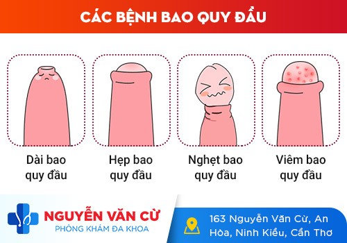 Khám dương vật ở đâu uy tín CẦN THƠ?