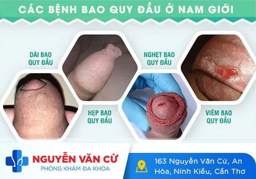 Nguyên nhân và cách chữa giảm ham muốn hiệu quả