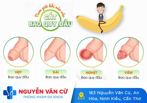 Bao quy đầu bị lở loét là bị gì?