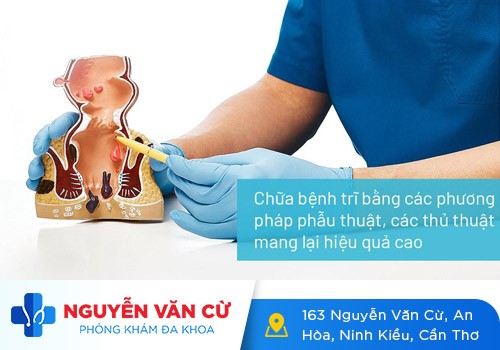 Mổ Trĩ Có Nguy Hiểm Không?