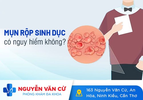 Mụn vùng kín (bộ phận sinh dục) nam giới