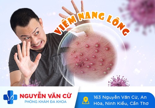 Mụn Nhọt Vùng Kín – Dấu Hiệu Bệnh Lý Nguy Hiểm Đừng Vội Chủ Quan