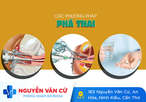 Đình chỉ thai 1 tuần – trên 2 tháng bằng cách nào?