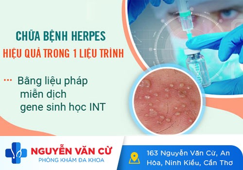 Herpes Môi – Nguyên Nhân, Triệu Chứng Và Cách Điều Trị