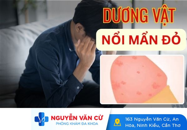 Dương vật nổi mẩn đỏ – Nguyên nhân và cách điều trị