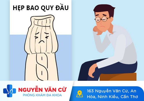 Thế Nào Là Hẹp Bao Quy Đầu?