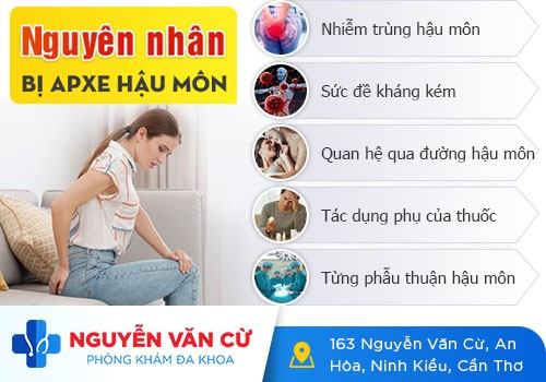 Điều trị áp xe hậu môn hiệu quả