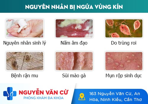 Chị em cần cẩn trọng với hiện tượng ngứa cô bé