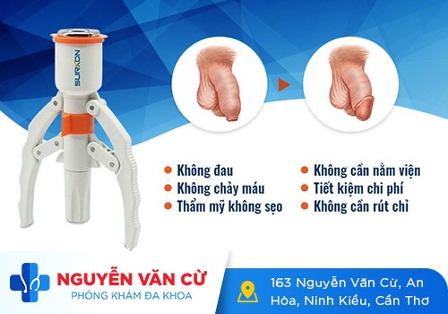 Cắt Bao Quy Đầu Bằng Máy Surkon An Toàn Tiết Kiệm Chi Phí