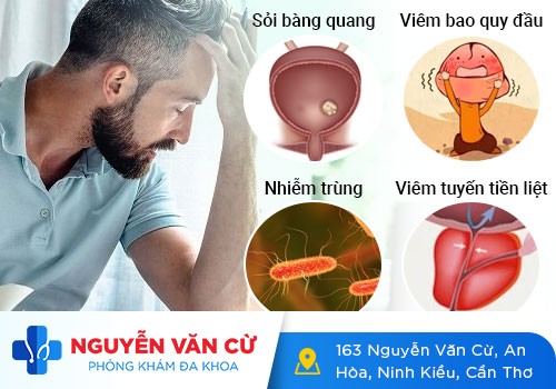 Đau dương vật sau quan hệ – dấu hiệu không nên bỏ qua