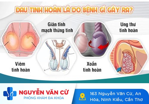 Chữa Đau Tinh Hoàn Tại Đa Khoa Nguyễn Văn Cừ