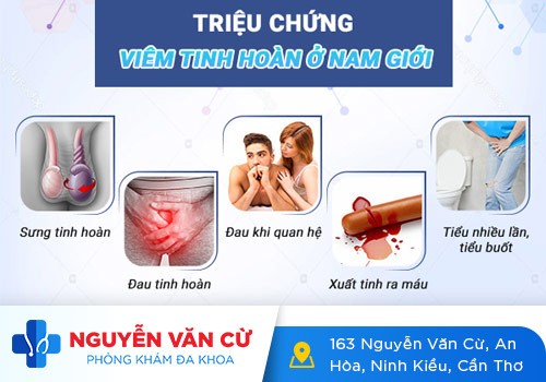 Có nên tự điều trị viêm tinh hoàn tại nhà?