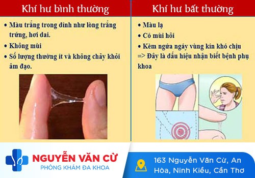 Làm rõ nguyên nhân khiến huyết trắng có mùi lạ