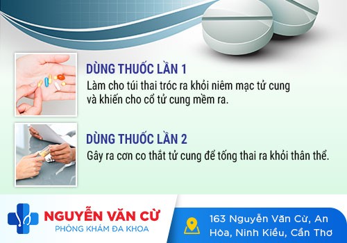 Phá thai bằng thuốc có đau không? Địa chỉ phá thai bằng thuốc không đau