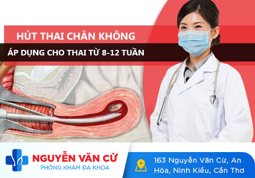 Các phương pháp bỏ thai an toàn chị em cần biết