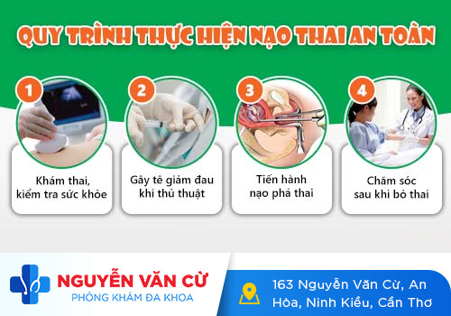 Phương pháp nạo thai an toàn
