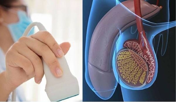 Siêu Âm Tinh Hoàn – Chẩn Đoán Bệnh Chính Xác