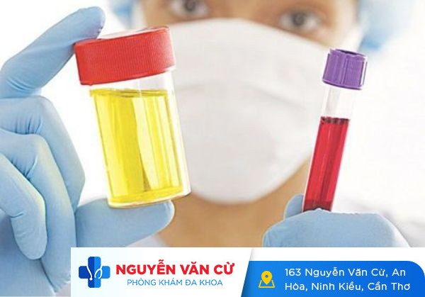 Cách Chữa Trị Tiểu Ra Máu Đạt Hiệu Quả Cao