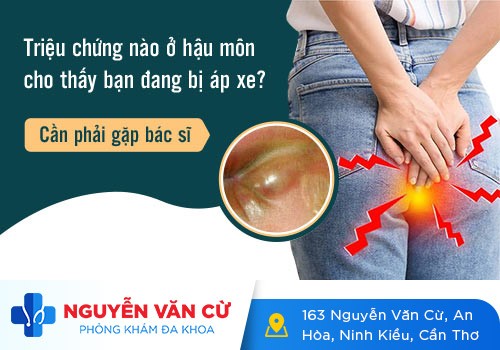 Phương pháp điều trị apxe hậu môn hiệu quả