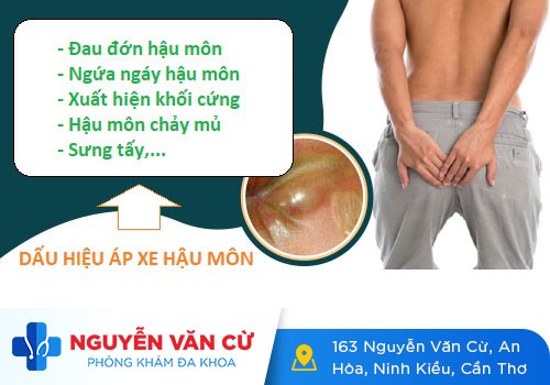 Áp Xe Hậu Môn Và Cách Điều Trị Hiệu Qủa