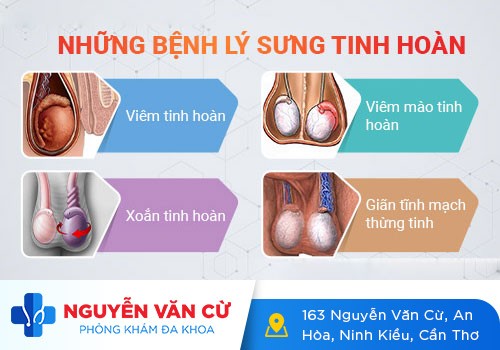 Phương Pháp Hỗ Trợ Điều Trị Sưng Tinh Hoàn Hiệu Quả