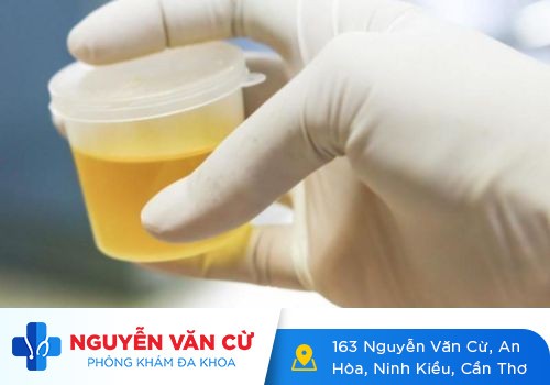 Nước tiểu có mùi hôi là do đâu?