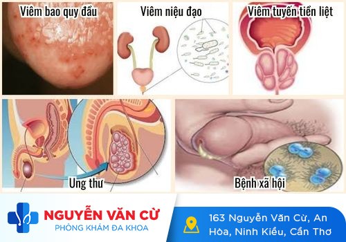 Bị đau dương vật – Chớ nên xem thường!