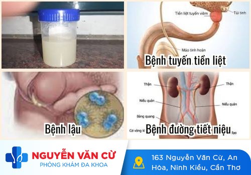 Nước tiểu đục – chạy ngay đi viện khi còn kịp