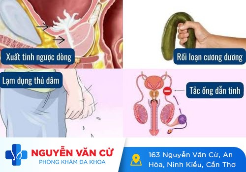 Nguyên nhân quan hệ không xuất, khó xuất tinh