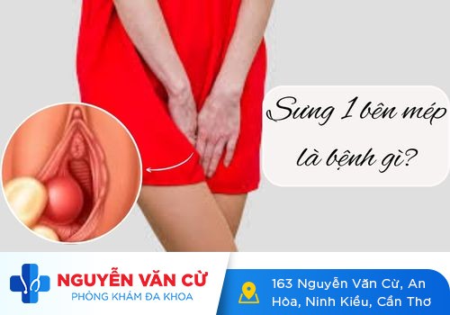 Vùng Kín Bị Sưng 1 Bên Mép Là Bệnh Gì?
