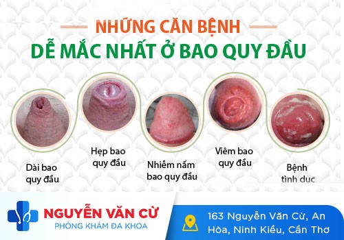 Bị Rách Da Ở Vùng Kín Nam: Mức Độ Nguy Hiểm Và Cách Điều Trị