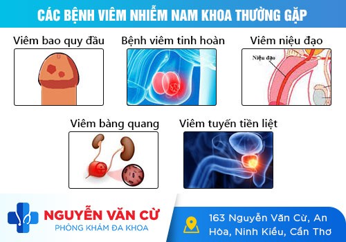 6 bệnh viêm nhiễm cơ quan sinh dục nam không nên bỏ qua