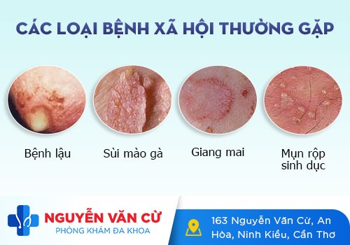 Tìm hiểu về STDs – Phương pháp xét nghiệm STD nhanh chóng, chính xác