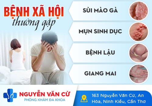 Các Bệnh Xã Hội Thường Gặp Ở Nam Giới