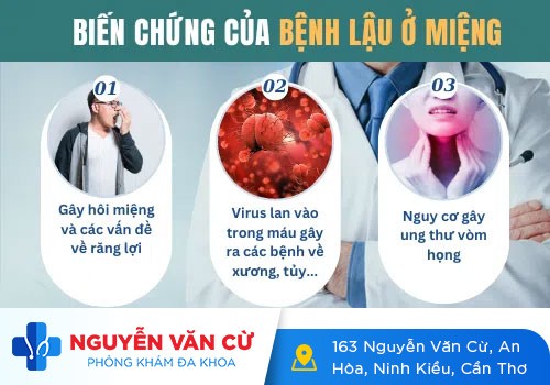 Hình Ảnh Bệnh Lậu Ở Lưỡi Nguyên Nhân Và Phương Pháp Điều Trị