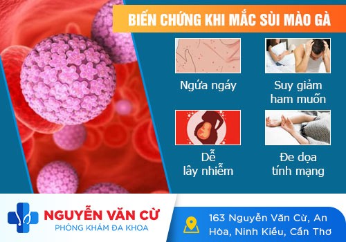 Bệnh sùi mào gà, căn bệnh dễ lây nhiễm nhưng khó điều trị