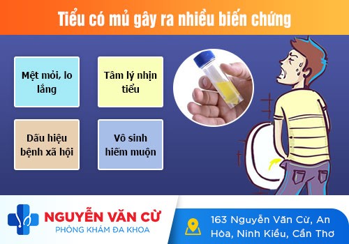 Đi Tiểu Buốt Có Mủ Ở Nam Và Nữ Là Dấu Hiệu Của Bệnh Nguy Hiểm Gì?