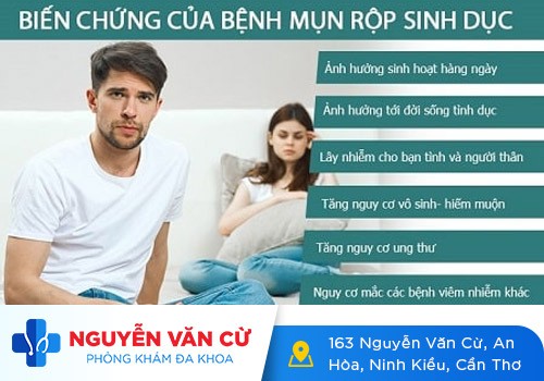 Cậu nhỏ nổi mụn có sao không?