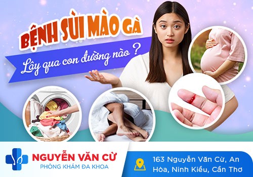 Condyloma Là Bệnh Gì – Dấu Hiệu Và Cách Điều Trị Hiệu Quả