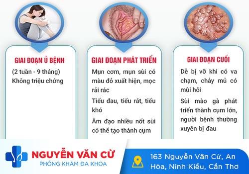 Sùi mào gà nữ và những điều cần biết
