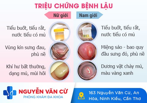 Nguy cơ tử vong cao khi mắc bệnh lậu mãn tính