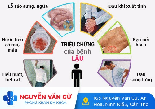Triệu chứng bệnh lậu ở nam giới? Phải làm gì khi biết mình bị lậu?