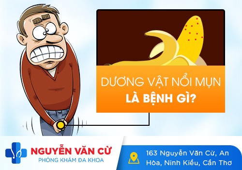 Nổi Mụn Li Ti Ở Cậu Nhỏ Là Dấu Hiệu Của Bệnh Gì?