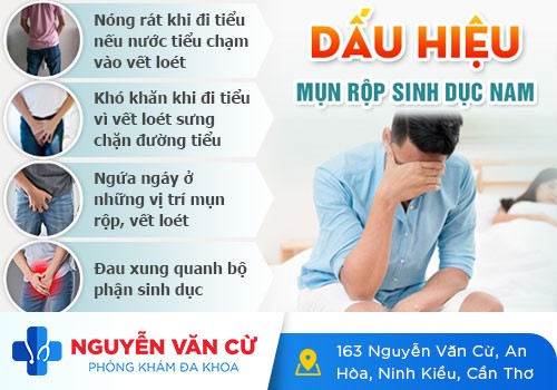 Bệnh mụn rộp sinh dục ở nam giới và cách hỗ trợ điều trị