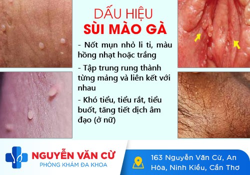Cách Trị Mụn Trứng Cá Ở Vùng Kín Hiệu Quả