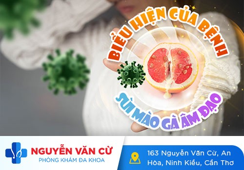 Sùi Mào Gà Ở Âm Đạo: Nỗi Ám Ảnh Và Lo Sợ Của Nhiều Người