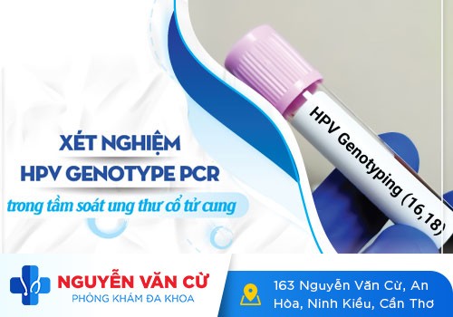 Bảng Giá Xét Nghiệm Sùi Mào Gà Mới Nhất