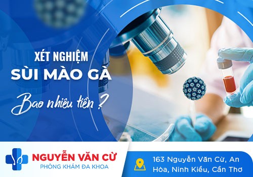 Chi Phí Xét Nghiệm HPV Hết Bao Nhiêu Tiền?