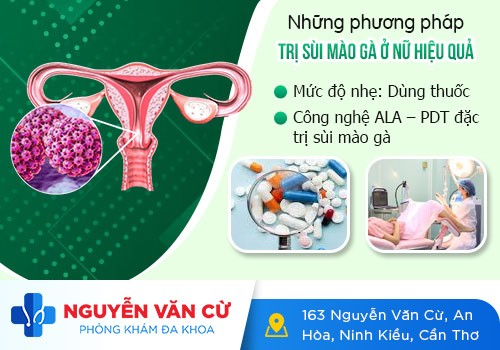 Bệnh sùi mào gà ở nữ giới và những thông tin cần biết